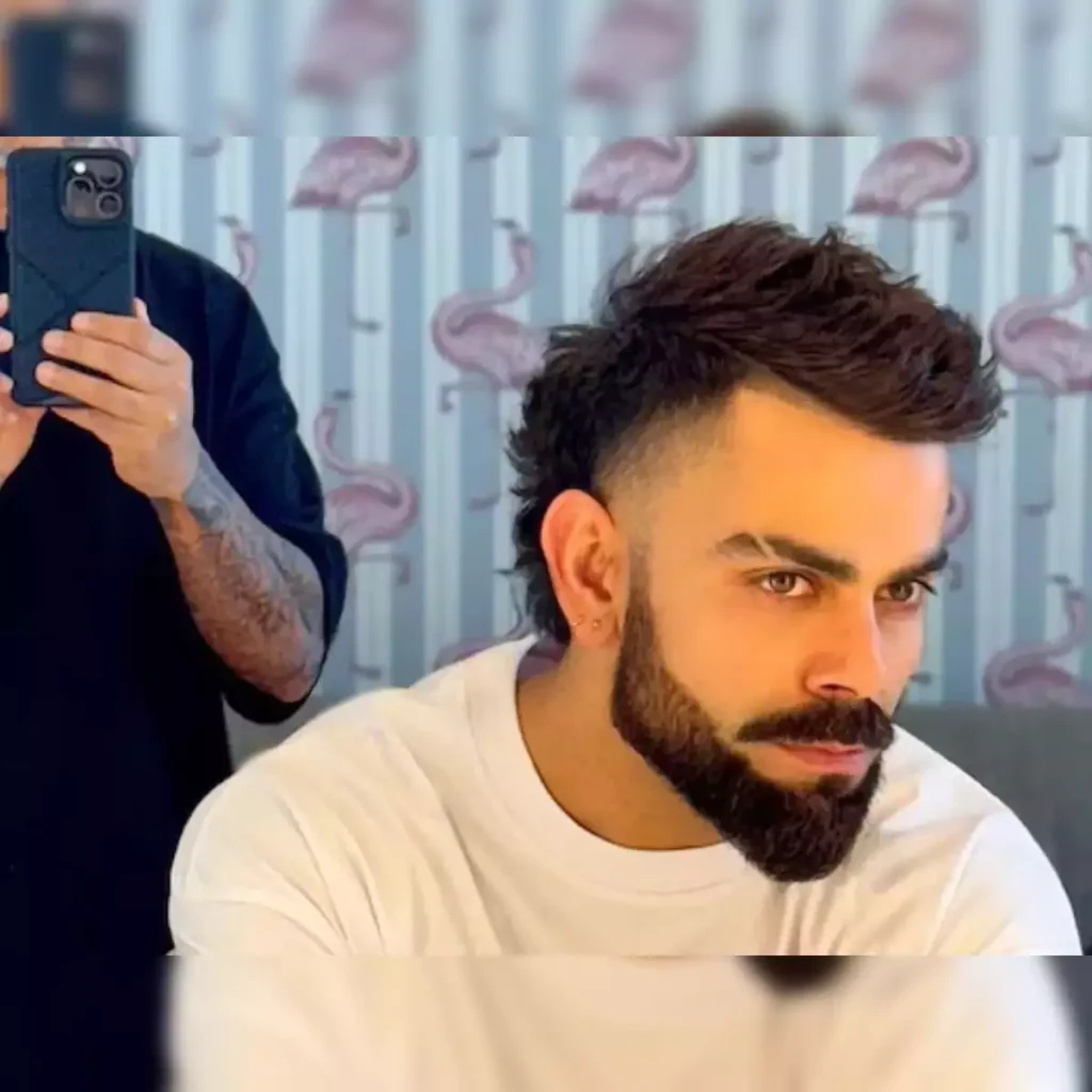 Does Virat Kohli Have a Hair Transplant? 